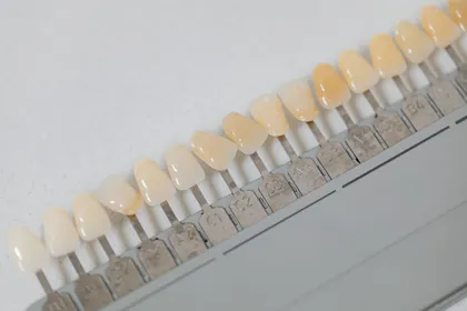 Escala de cores dentárias